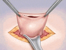 1764015916_29394e61d3d28b0438272f3a84332c7a-2 1764015916 29394e61d3d28b0438272f3a84332c7a 2 1