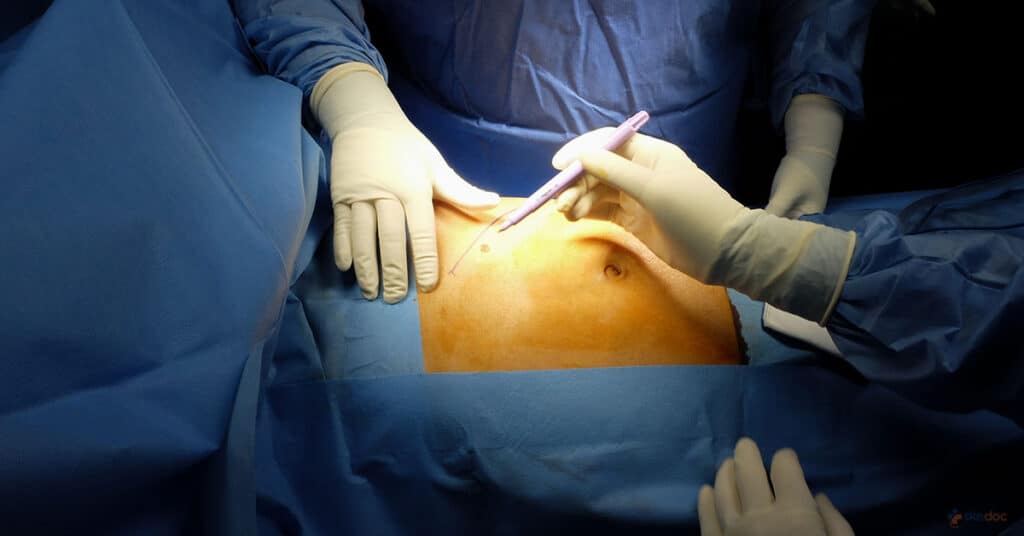 Surgery photo_1 Surgery photo 1