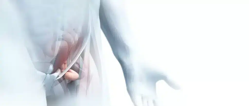 femoralhernien-1-1 femoralhernien 1 1