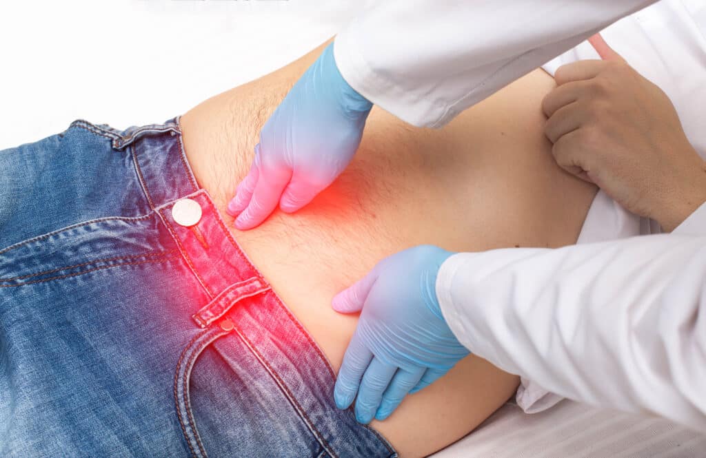 A surgeon examining a man's belly button hernia