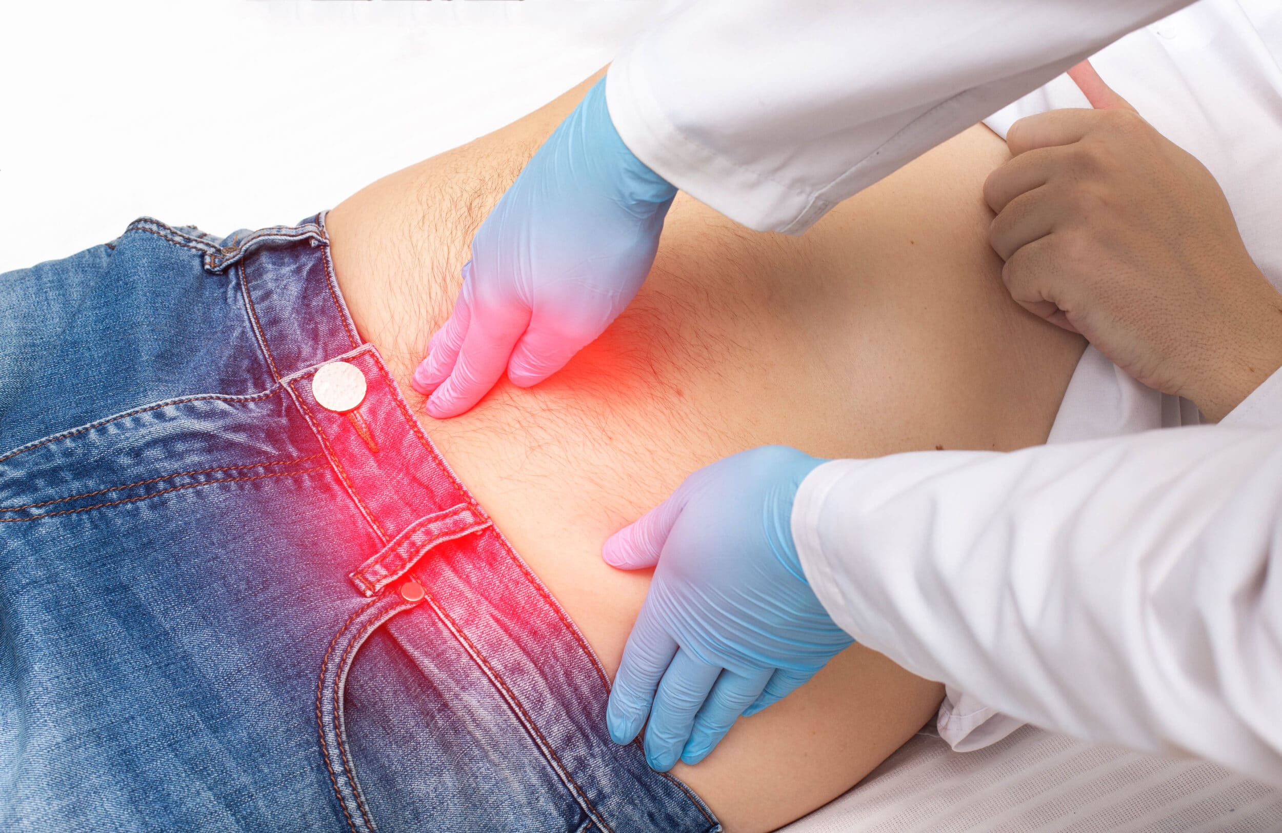 A surgeon examining a man's belly button hernia